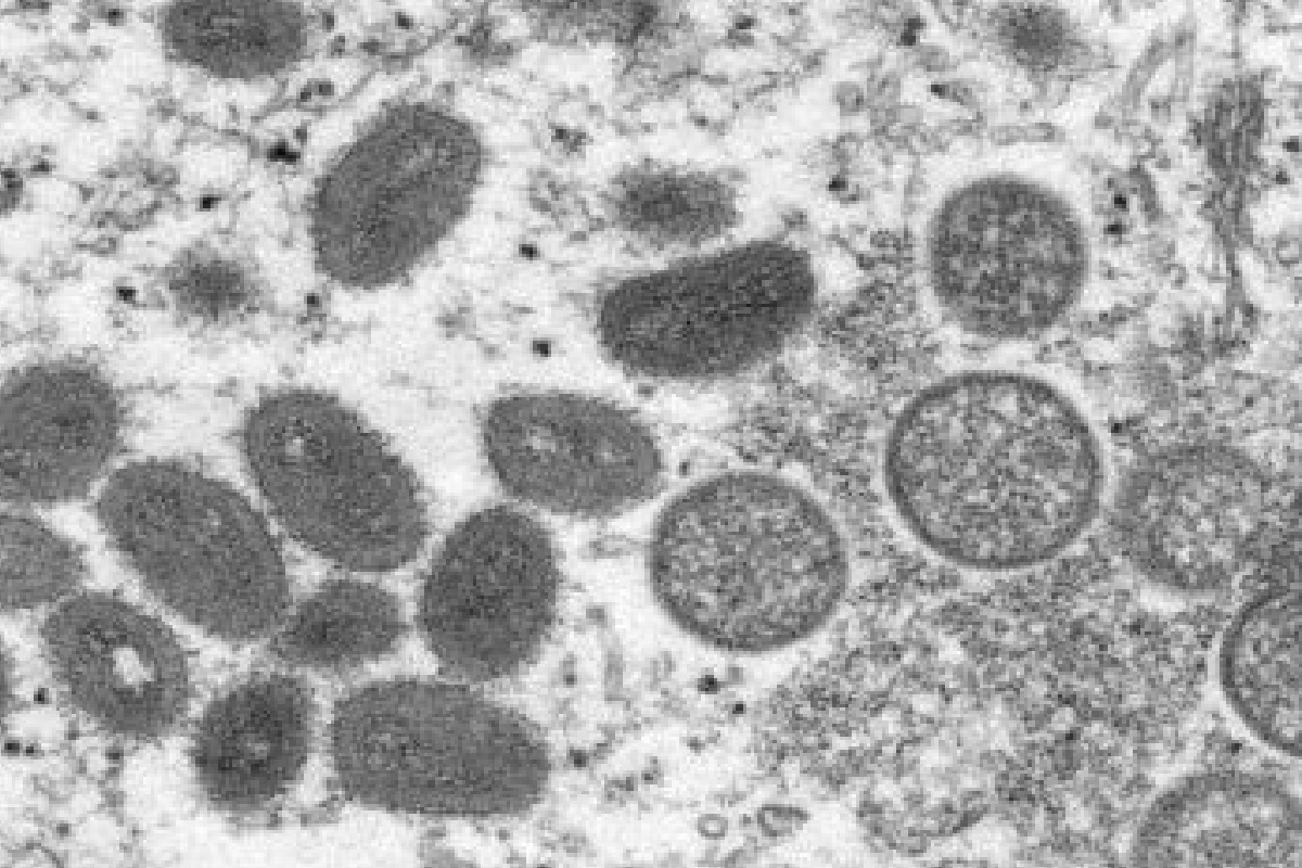 Vírus da Varíola dos Macacos Foto: Reprodução | Centers for Disease Control and Prevention