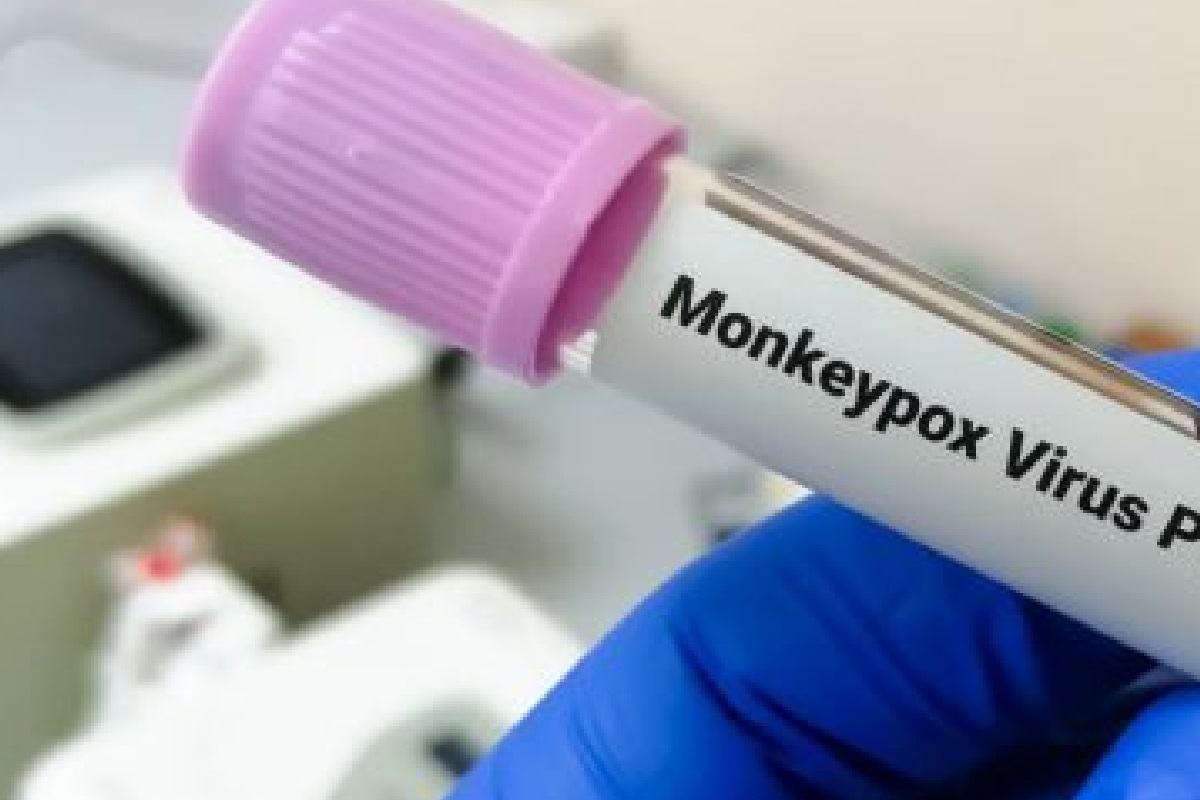 Teste PCR varíola dos macacos Foto: Reprodução | ONU Brasil